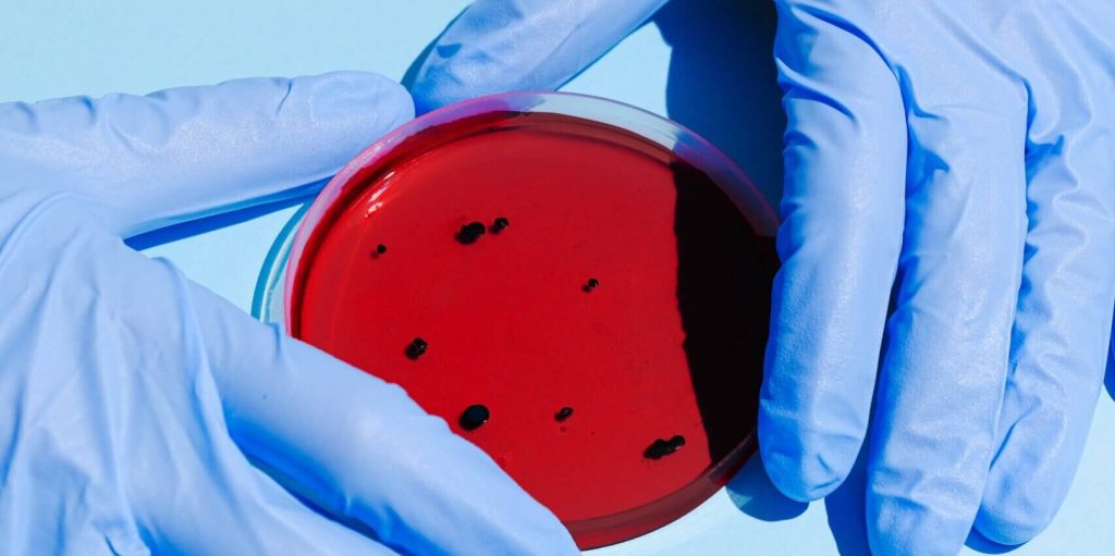 CDC Study Highlights Need for Ongoing Monitoring to Identify Emergence of Antibiotic-Resistant Bacteria in Community Settings